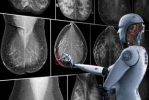 AI 通过筛选出误报来改善乳腺癌诊断
