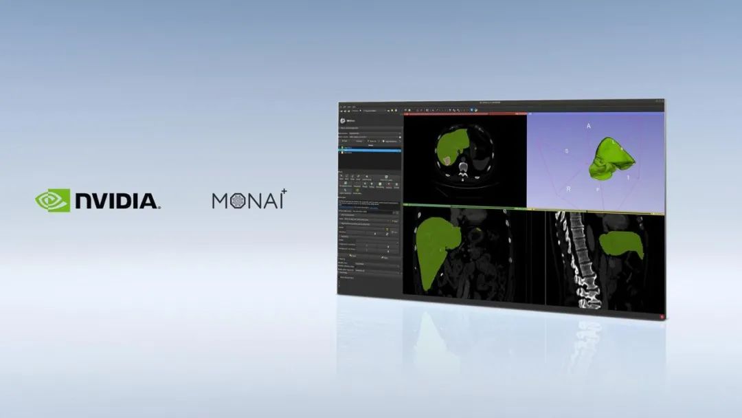 MONAI成像框架快速投入生产，加速医疗健康领域的AI应用
